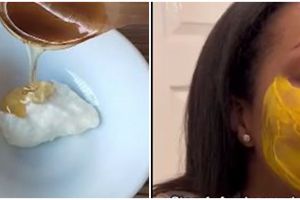 Tanpa krim pencerah, wanita ini hilangkan hiperpigmentasi pakai kunyit di campur 1 bahan alami