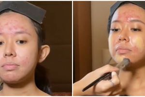 Transformasi cewek dengan wajah jerawat meradang dirias ala fresh makeup, hasilnya simpel dan flawless