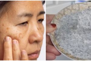 Tak cuma pakai yogurt, TikToker ini bagikan cara atasi flek hitam dengan tambahan 1 jenis biji-bijian