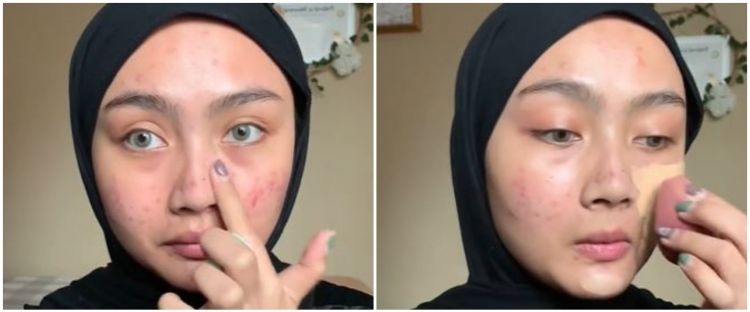 Transformasi makeup cewek kulit berjerawat rias wajah ala peach makeup, hasilnya flawless auto mulus