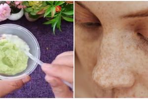 Usia 50-an terlihat 10 tahun lebih muda, ini cara mengatasi flek hitam pakai 1 jenis sayuran