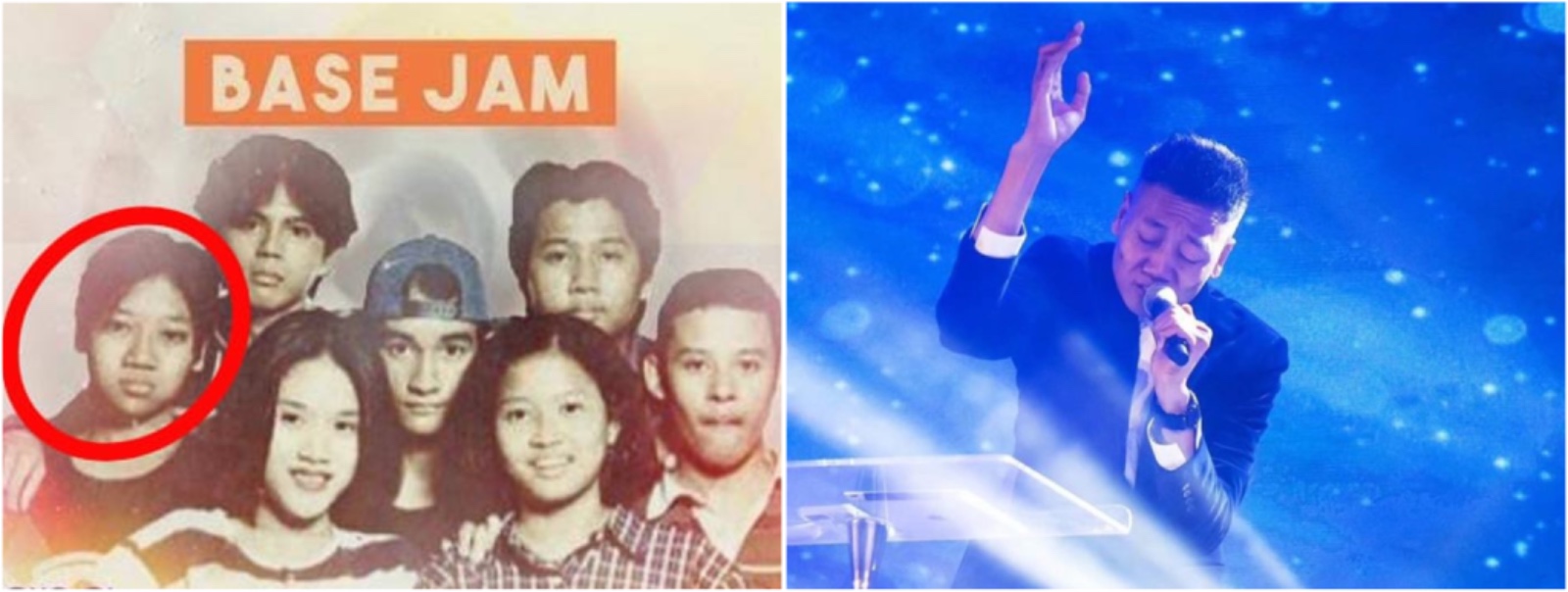 Curhat Adon eks Base Jam berjuang sembuh dari sakit, harus injeksi tiga bulan sekali ke Kuala Lumpur