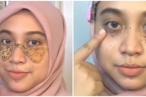 Bukan pakai eye cream, cara atasi kantung mata tebal ala wanita ini cuma dengan 1 jenis bahan dapur