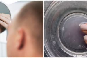 Tanpa tonic rosemary, ini cara mengatasi rambut botak agar tumbuh lebat cuma pakai 1 bumbu dapur