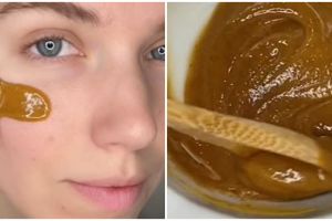 Tak perlu acne patch, TikToker ini bagikan cara atasi jerawat meradang pakai 3 bahan dapur