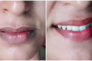 Tak cuma gula pasir, wanita ini bagikan cara atasi bibir hitam dan kering pakai tambahan 1 jenis buah