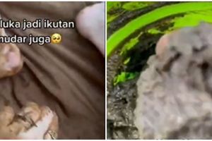 Tanpa tomat, wanita ini bagi tips cerahkan bekas luka menghitam pakai limau dicampur 1 bubuk minuman