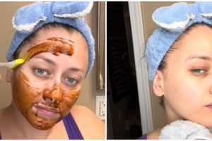 Nggak perlu suntik kolagen, cewek ini bagikan cara atasi keriput di area wajah pakai 2 bahan dapur