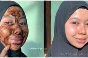Cuma modal Rp 3 ribu, cewek ini bagikan cara kencangkan kerutan wajah pakai 2 bahan dapur
