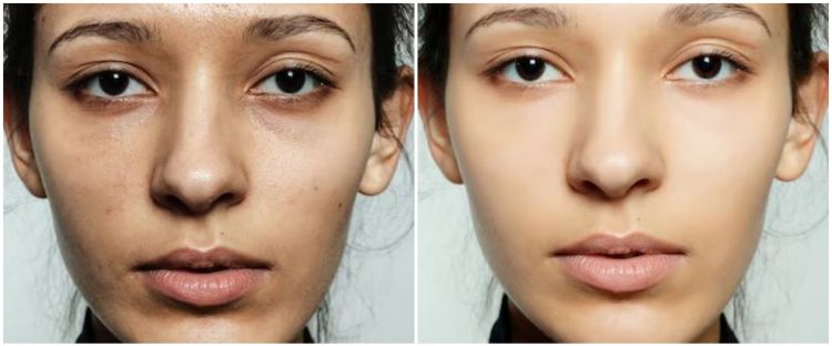 Buah-buahan Raja: Nggak Cuma Gurih, Tapi Nyamanin Tubuh Sampai Kelebuuu