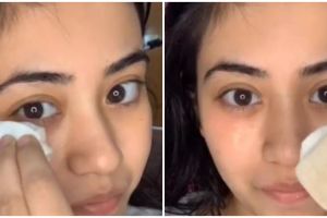 Nggak cuma pakai timun, ini cara atasi kantung mata tebal dengan tambahan 1 jenis umbi-umbian