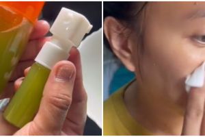 Tanpa serum vitamin C, TikToker ini bagikan cara bikin toner pudarkan flek hitam pakai 2 bahan alami