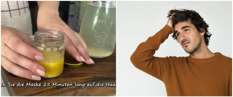 Auto tumbuh lebat kembali, ini trik atasi rambut botak tengah pada pria pakai 1 bahan makanan