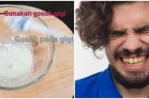 Tak ditambah cuka apel, YouTuber ini bagikan cara hilangkan plak kuning di gigi pakai 2 bahan dapur
