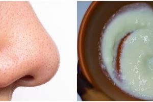 Bukan dengan nose strip, TikToker ini bagikan cara hempas komedo di wajah pakai 1 jenis buah