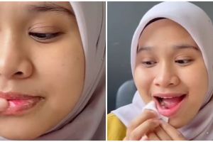 Tak perlu tambahan petroleum jelly, ini trik cerahkan bibir hitam cuma pakai 2 bahan pemanis