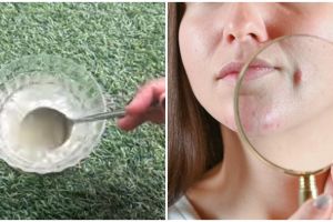 Tak dicampur lidah buaya, wanita ini bagikan cara mengecilkan pori-pori membesar pakai 1 jenis makanan