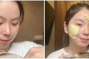 Tak gunakan krim pencerah, wanita ini bagikan cara hilangkan bekas luka di wajah pakai 1 bahan rempah