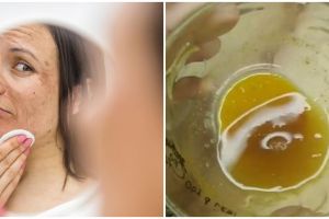 Tak perlu serum retinol, ini trik pudarkan flek hitam membandel di wajah pakai 2 bahan dapur