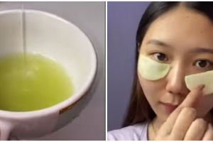 Tanpa eye cream, cewek ini bagikan cara hilangkan kantung mata pakai lidah buaya pakai 1 bahan alami
