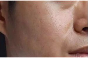 Tak gunakan kopi, ini cara mengecilkan pori-pori di wajah agar terlihat mulus cuma dengan 1 ampas buah