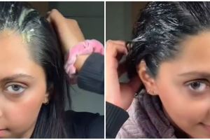 Bukan pakai tonic rosemary, trik menumbuhkan rambut mudah rontok ini cuma butuh 2 bahan dapur