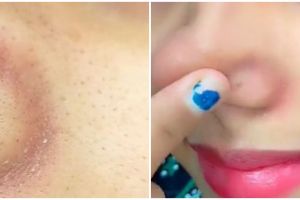 Sudah ditonton 9,1 juta kali, wanita ini bagikan trik angkat komedo di hidung pakai 1 jenis buah