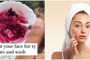 Tanpa gunakan acne patch, wanita ini bagikan cara hilangkan jerawat pada wajah pakai 1 jenis umbi-umbi