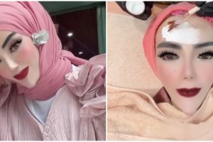 9 Momen Yuni Jasmine si dagu lancip perawatan kecantikan, wajah aslinya justru dipuji cantik natural