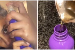 Tak perlu tonic mahal, wanita ini bagikan cara tumbuhkan rambut pitak pinggir pakai 2 bahan dapur