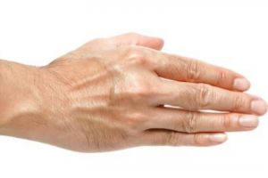 Tak perlu beli hand cream, ini trik atasi tangan kering keriput jadi lembut pakai 1 bahan pemanis