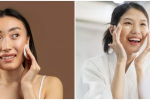 9 Cara mengontrol kulit berminyak ala dokter ini bikin wajah sehat dan bebas jerawat