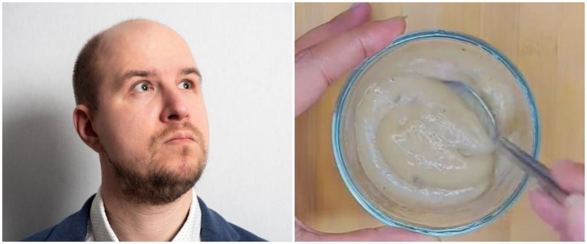 How To Grow Bald Hair