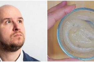 Tak perlu tonic rosemary, TikToker ini bagikan cara tumbuhkan rambut botak pakai 3 bahan alami