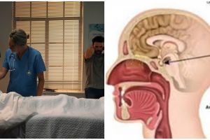 Kenali penyebab munculnya penyakit Empty Sella, kondisi langka yang menyerang bagian otak Ruben Onsu