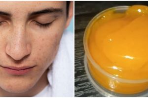 Tak cuma pakai kunyit, ini cara bikin face serum pudarkan flek hitam dengan tambahan 1 bahan alami