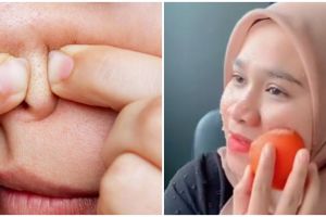 Tanpa facial mahal, wanita ini bagikan cara atasi komedo hitam dan putih di wajah pakai 2 bahan dapur