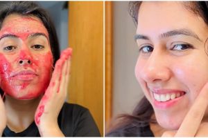 Tak pakai krim pencerah, cewek ini bagikan cara hilangkan flek hitam pakai 1 jenis umbi-umbian