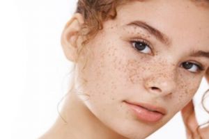 Bukan pakai kopi, emak-emak ini bagikan trik pudarkan flek hitam di wajah dengan 3 bahan alami