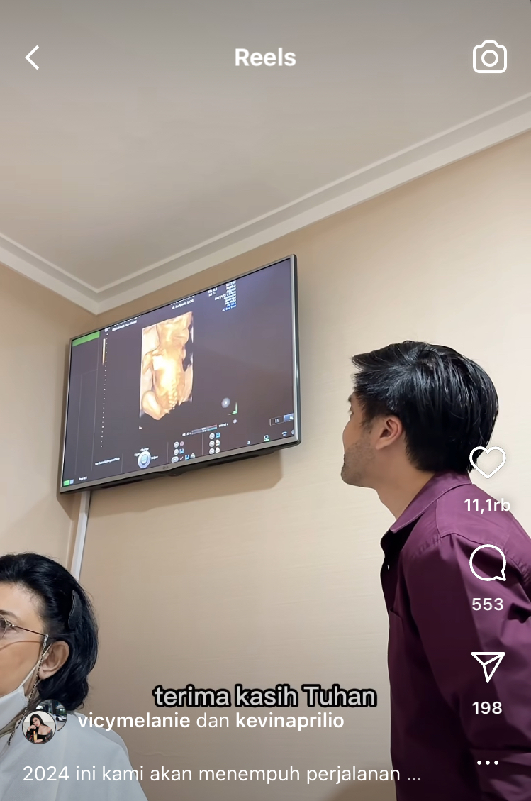 Buah sabar menanti anak pertama, 7 momen bahagia Kevin Aprilio umumkan istri hamil usai 4 tahun nikah