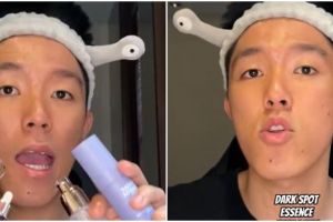 Battle review 5 dark spot serum di bawah Rp 200 ribu ini diklaim bisa atasi flek hitam, mana juaranya?