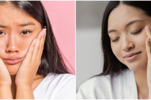 Tak perlu suntik putih, kombinasi alpha arbutin dengan 3 kandungan skincare ini bikin wajah auto cerah
