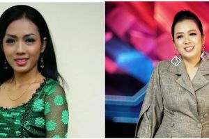 Rela habiskan uang puluhan juta rupiah, ini 7 potret penyanyi sebelum dan sesudah veneer gigi