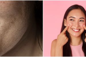 Jadi halus dan bebas pecah-pecah, ini cara atasi kulit kering pakai body lotion dicampur 1 produk