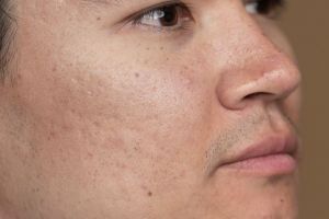 Tak perlu face scrub mahal, cewek ini bagikan cara bersihkan pori-pori wajah cuma pakai 1 bahan alami