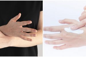 Tanpa chemical peeling, beauty vlogger ini bagikan cara atasi tangan belang pakai 1 jenis tanaman