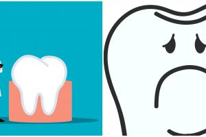 Sering dianggap sepele, ini 7 efek samping jika gigi bungsu tidak dicabut