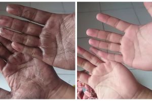 Bukan digosok sabun, ini trik bersihkan noda oli hitam yang menempel di tangan andalkan 1 bahan dapur