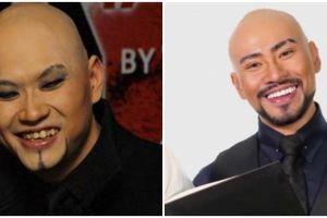 Potret 18 seleb sebelum & sesudah reparasi gigi berubah drastis, senyum Deddy Corbuzier makin menawan