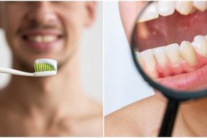 Solusi saat produk habis, dokter ini bagikan cara membuat pasta gigi dari 1 jenis minyak